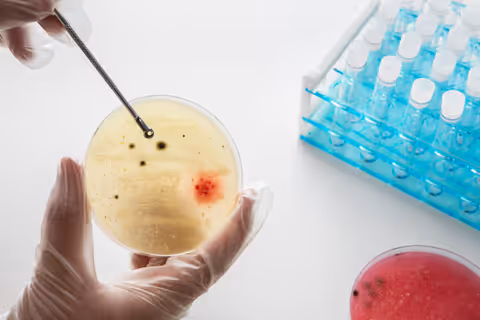 Assay Development Guide: Explore Analytical Methods, Validation Insights, and Essential Information